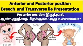 Anterior position and Poster position | Posterior placenta means boy or girl,Placenta anterior