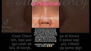 Failed Plastic Surgery, handled by ORIBIA BEAUTY INTERNATIONAL AGENT. Instagram @oribiahansu