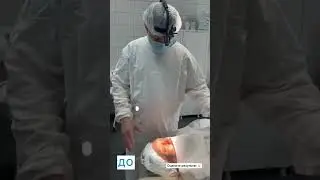 Краснодар! Клиника «Здрава» Избавили мужчину от мешков под глазами. Врач-Кобец Р.А. Тел.88002504012