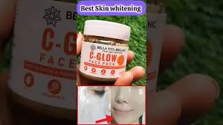face whitening face pack | best face pack for glowing skin| #glowingskin #kojicare #skin