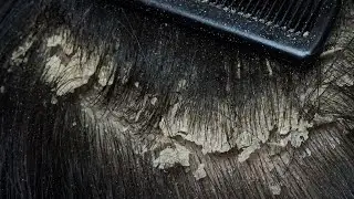 ASMR Ultimate Relaxation Scalp Care #44