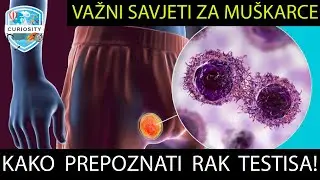 Znakovi i simptomi raka testisa, prevencija... Dr#118