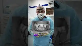 Моментальное восстановление зуба имплантом