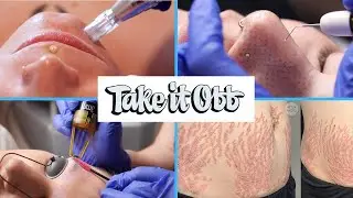 Take It Off: Tattoo Removal & Alt Spa (Medical Spa Promo)