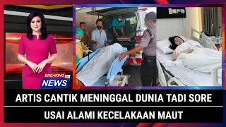 artis cantik alami kecelakaan