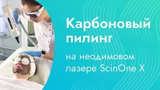 Карбоновый пилинг на лазере ScinOne X