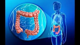 Why, When and How to Perform Manual Colostomy Reversal Following Wide Colorectal Resection at a