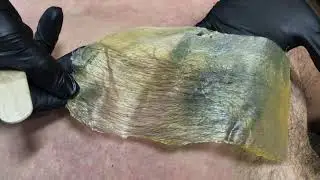 Full back wax performed by waxing specialist, Claire at Pro Beauty North