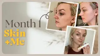 Skin + Me, 1 Month Review | Clearing My Pigmentation