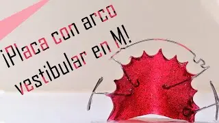Placa con arco vestibular simple en M | Elena Dental Art & More