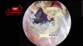 FULL Ear Wax Removal || Satisfying || BUSTY POPER