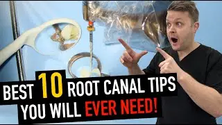 10 Game-Changing Root Canal Tips (You’ll Use Tomorrow!)