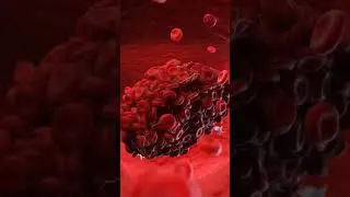 Female Private Part surgery without Complications, vaginoplasty in Vesu, City light, Althan, Surat.