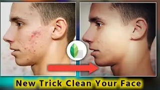 How To Clean Face +Remove Pimples + Clear Face |Face Ko Smooth kesy karen | just 4 you