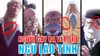 Đây là những nhân vật đã gây ra vết sẹo cho Ngũ Lão Tinh