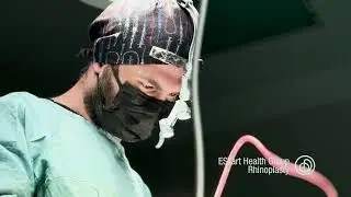 ESTart Health Group Rhinoplasty