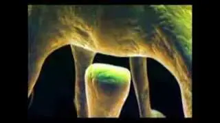 Alzheimer solution V01