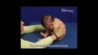 4 Month Old Babies in Sitting Position, demonstrating Typical and Atypical Development