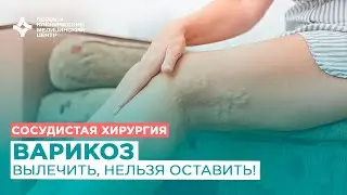 Варикоз - вылечить, нельзя оставить
