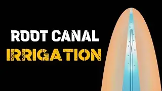 ROOT CANAL IRRIGATION