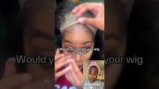 Wig Glue Gone Wrong: My Worst Hair Disaster #wiginstall #lacewigs #hairloss