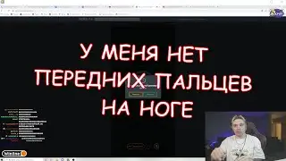 У Андрея стопталась нога