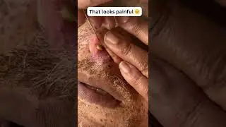 That looks painful 😑