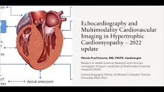 Echocardiography and Multimodality Cardiovascular Imaging in Hypertrophic Cardiomyopathy 2022 Update
