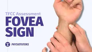 Fovea Sign | TFCC Lesions