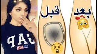 كيف أبييض المناطق الحساسة وبين الفخدين؟ لن تصدقي النتيجة تبييض سريع ودائم/تجربتي الخاصة, للبنات فقط!