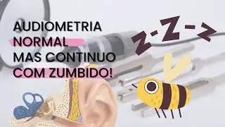 Zumbido: Diagnóstico Diferencial para o Tratamento
