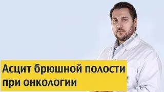 Асцит брюшной полости при онкологии