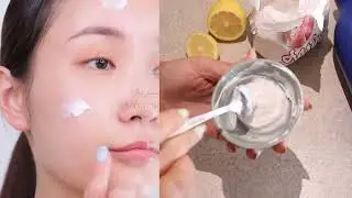 3 مكونات فقط ستجعل بشرتك أصفى من الحليب تبييض قوي وسريع للوجه /الوصفة السحرية