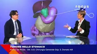 Stomach Cancer