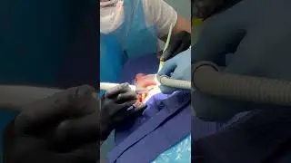 Профессиональная гигиена полости рта