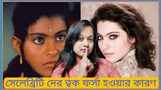 সেলেব্রিটি দের ত্বক কিভাবে এত ফর্সা হয়ে যায়? ফর্সা হওয়ার আসল উপায় |  Celebrity Skin Whitening