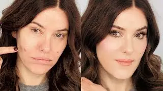3 Tactics for Dealing with a Large Swollen Blemish