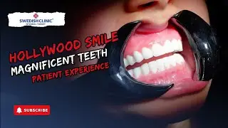 Hollywood smile - Magnificent teeth