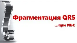 fQRS