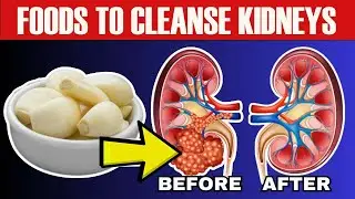 10 Foods That Will CLEANSE Your Kidneys FAST!