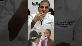 Yellow Gums after laser treatment?