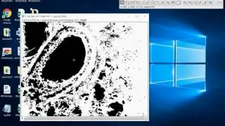 Using ImageJ to Quickly Analyze Lung Slice Airway Area