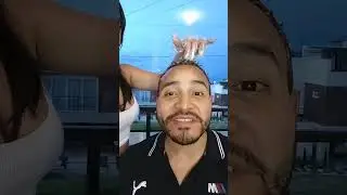 Pintándome el pelo por buenas causas #arbitrum