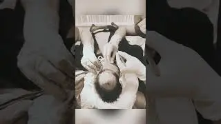 Трансплантация волос в клинике