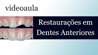 9º Aula Dentística - Restaurações em Dentes Anteriores