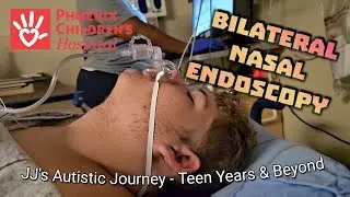Bilateral Nasal Endoscopy