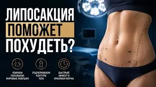 ЛИПОСАКЦИЯ ПОМОЖЕТ ПОХУДЕТЬ // ЛИШНИЙ ВЕС