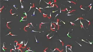Boar sperm sample
