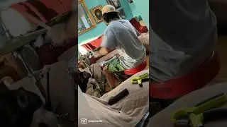 Amputee ampupete