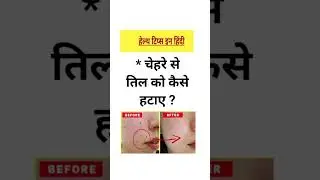 चेहरे से तिल को कैसे हटाएं || How to remove mole from face #mole #generalknowledge  #shorts